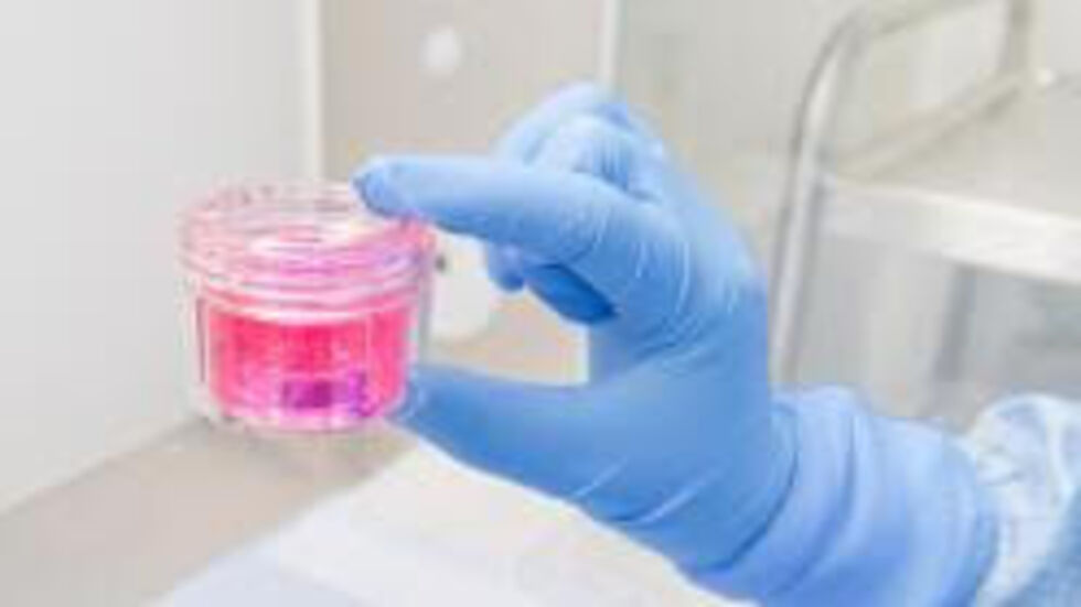 So sieht das Augenhornhauttransplantat in einer Nährlösung aus.